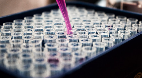 血液中心污水處理工藝原理及處理方法-污水處理流程-污水處理工藝 血液中心污水處理工藝原理及處理方法-污水處理流程-污水處理工藝